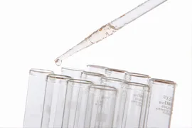 当院のアレルギー検査